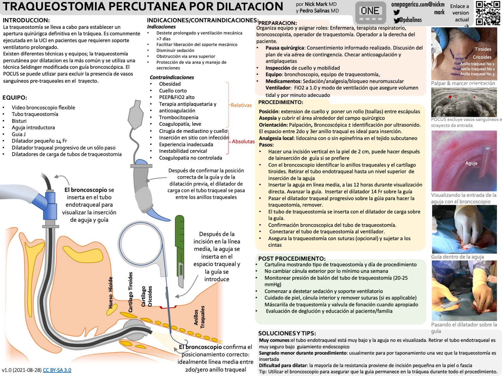 Tracheostomy — ICU One Pager